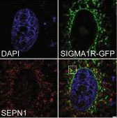 Defective endoplasmic reticulum-mitochondria contacts and bioenergetics in SEPN1-related myopathy